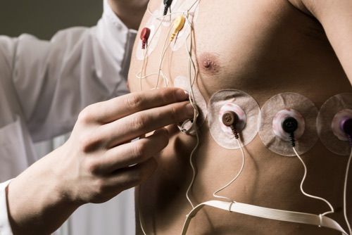 Sistema de Biyectiva para análisis biomecánico del pie mediante inteligencia artificial, visión artificial y procesamiento 3D